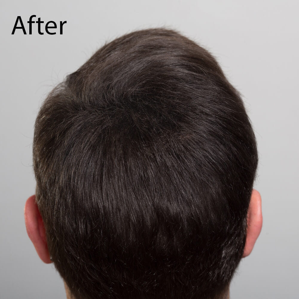 Sibel Hair Sculptor Hair Building Fibers - Dark Brown 25g