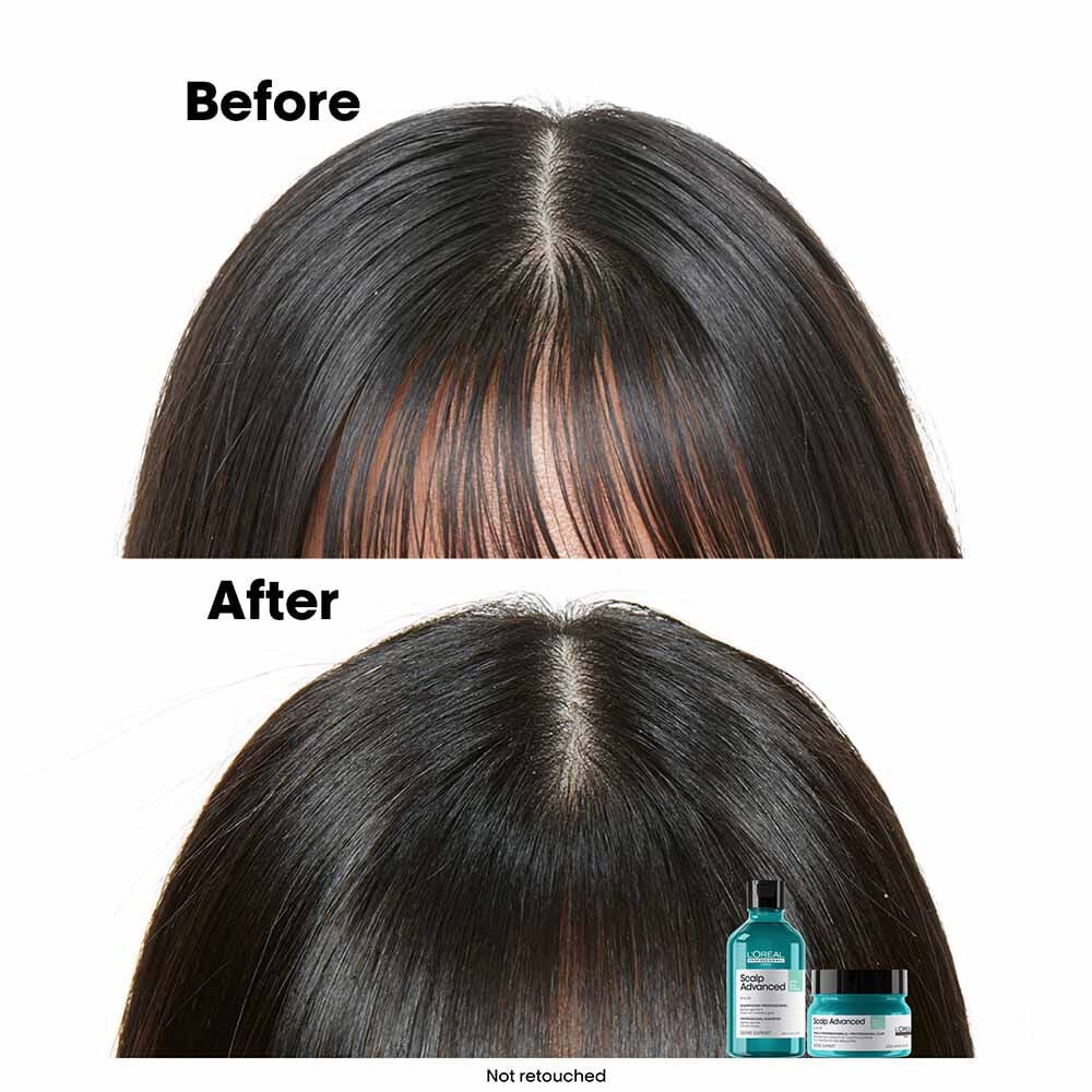 L'OrÃ©al Professionnel Serie Expert Scalp Advanced Anti-Oiliness Dermo Purifier Shampoo 300ml