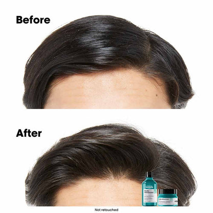 L'OrÃ©al Professionnel Serie Expert Scalp Advanced Anti-Oiliness Dermo Purifier Shampoo 300ml