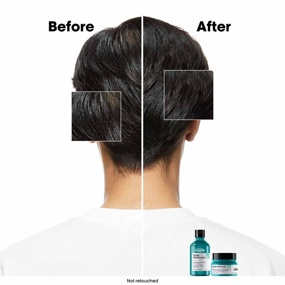 L'OrÃ©al Professionnel Serie Expert Scalp Advanced Anti-Oiliness Dermo Purifier Shampoo 300ml