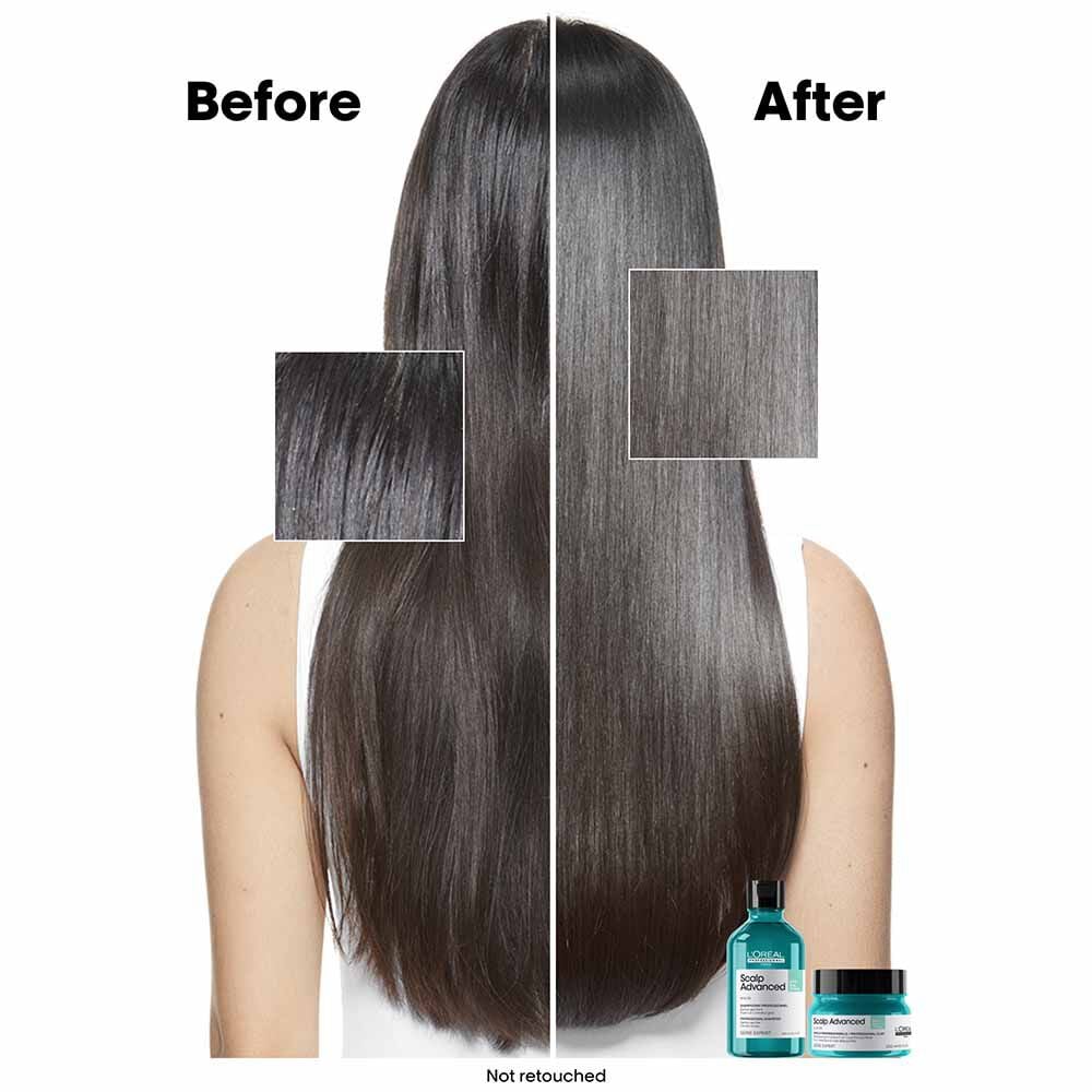 L'Oréal Professionnel Serie Expert Scalp Advanced Anti-Oiliness Dermo Purifier Shampoo 300ml