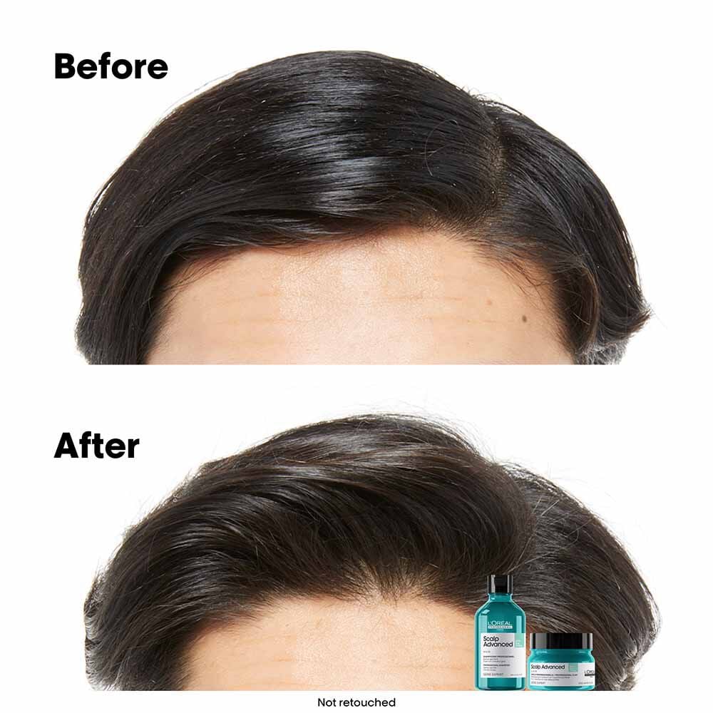 L'Oréal Professionnel Serie Expert Scalp Advanced Anti-Oiliness Dermo Purifier Shampoo 300ml