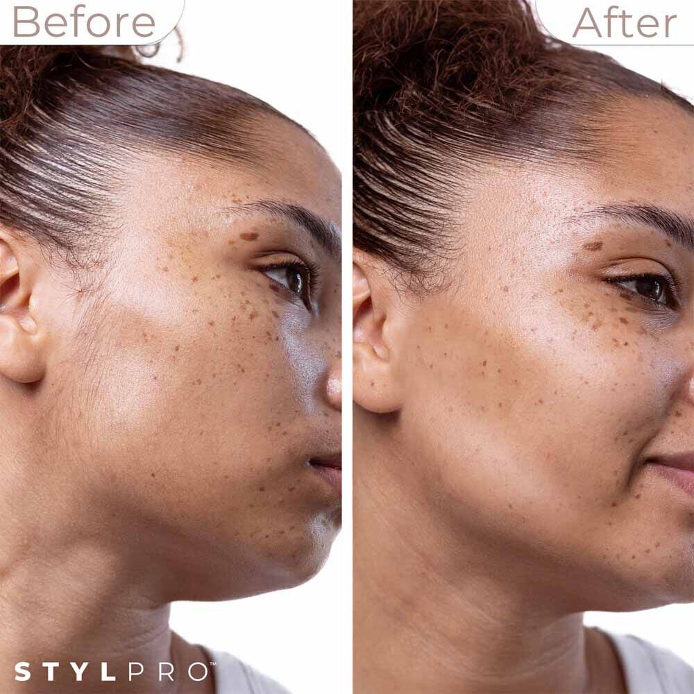 StylPro 2-in-1 Sonic Dermaplane