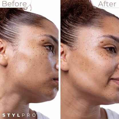 StylPro 2-in-1 Sonic Dermaplane