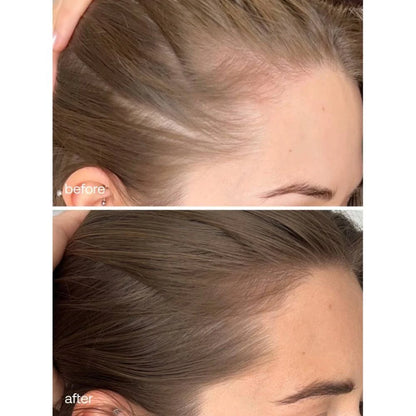 UKHAIR Advanced Hair Supplements (60)